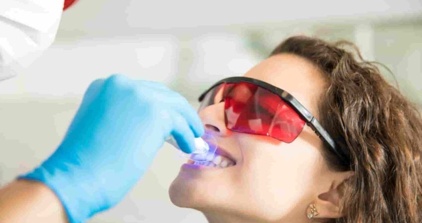blanqueamiento-dental