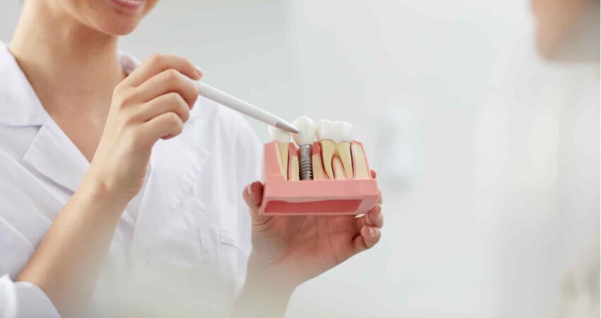 implantes-dentales