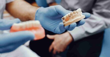 implantes-dentales-vs-puentes