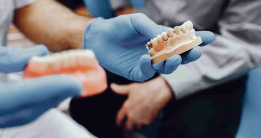 implantes-dentales-vs-puentes